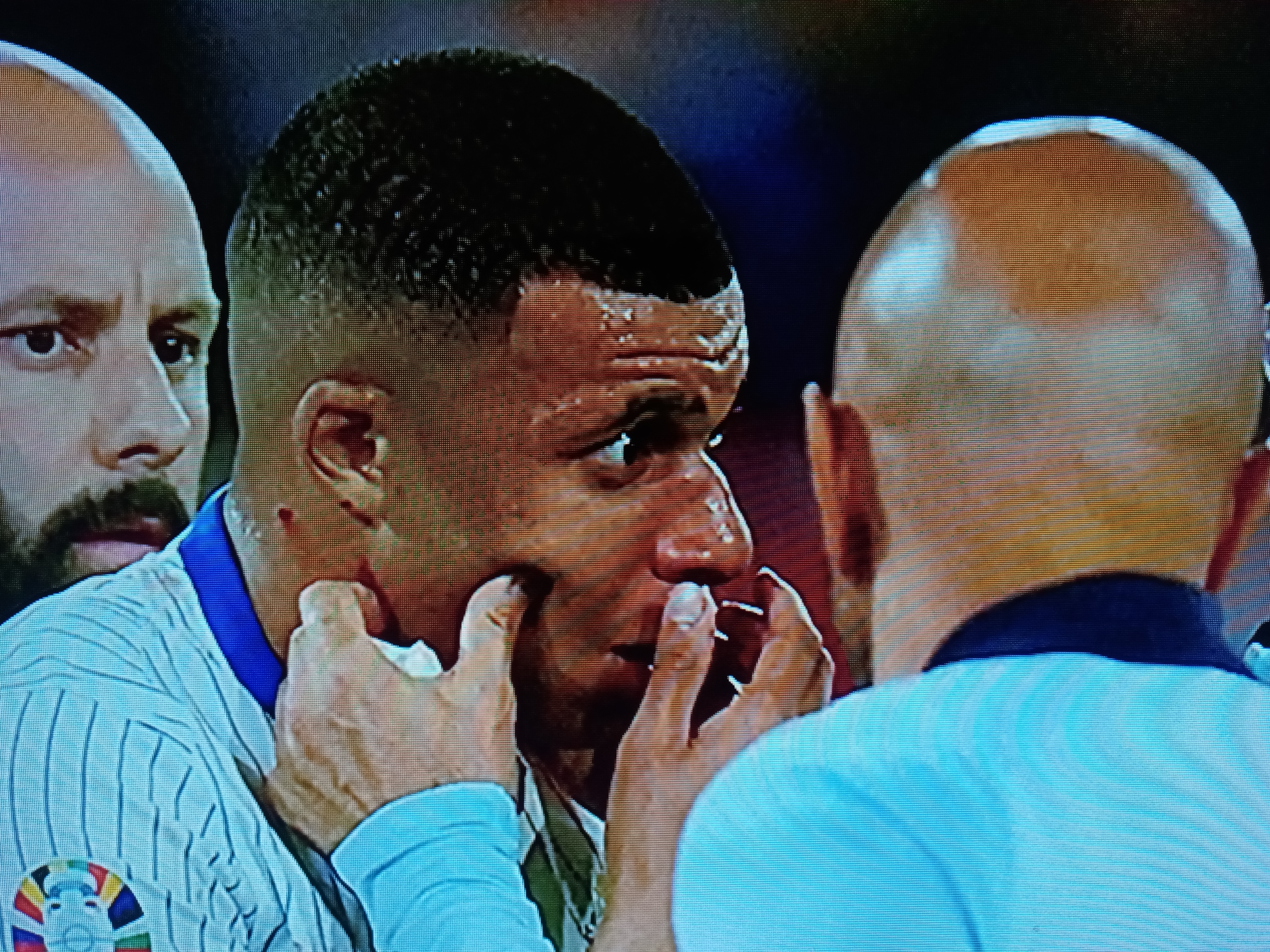 法国球员姆巴佩爆冷受伤!或将缺席欧洲杯决赛 法国球员姆巴佩爆冷受伤!或将缺席欧洲杯决赛